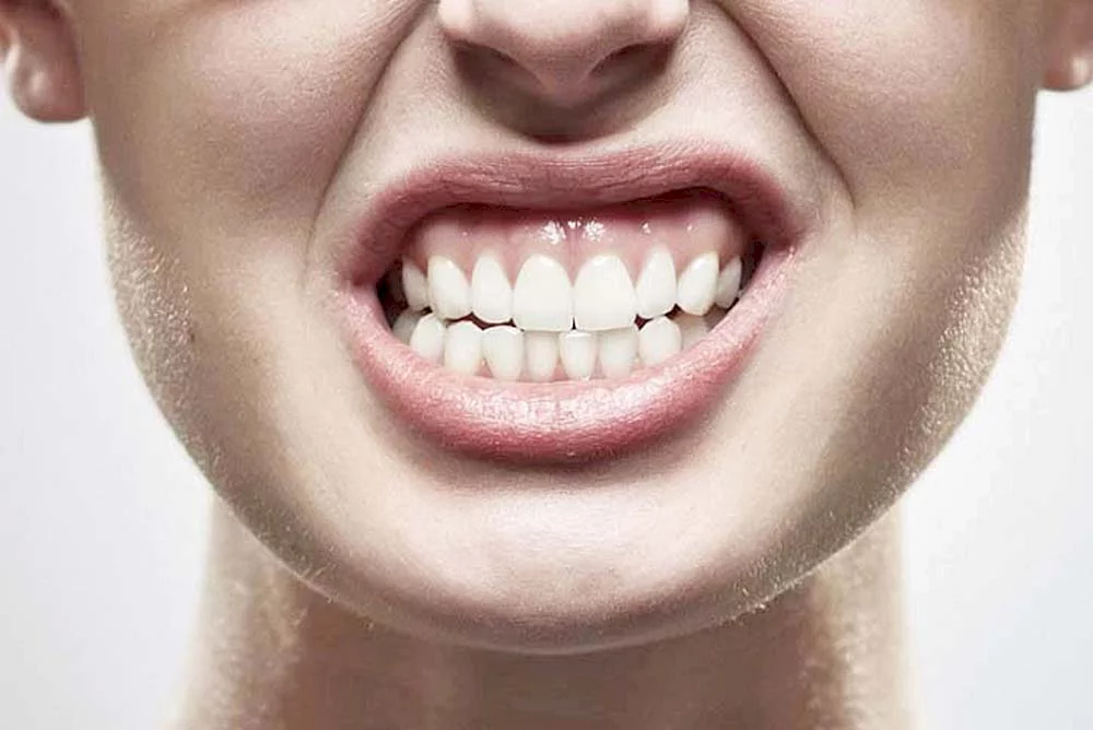 Bruxismo: A doença causada pelo estresse que pode prejudicar os seus dentes