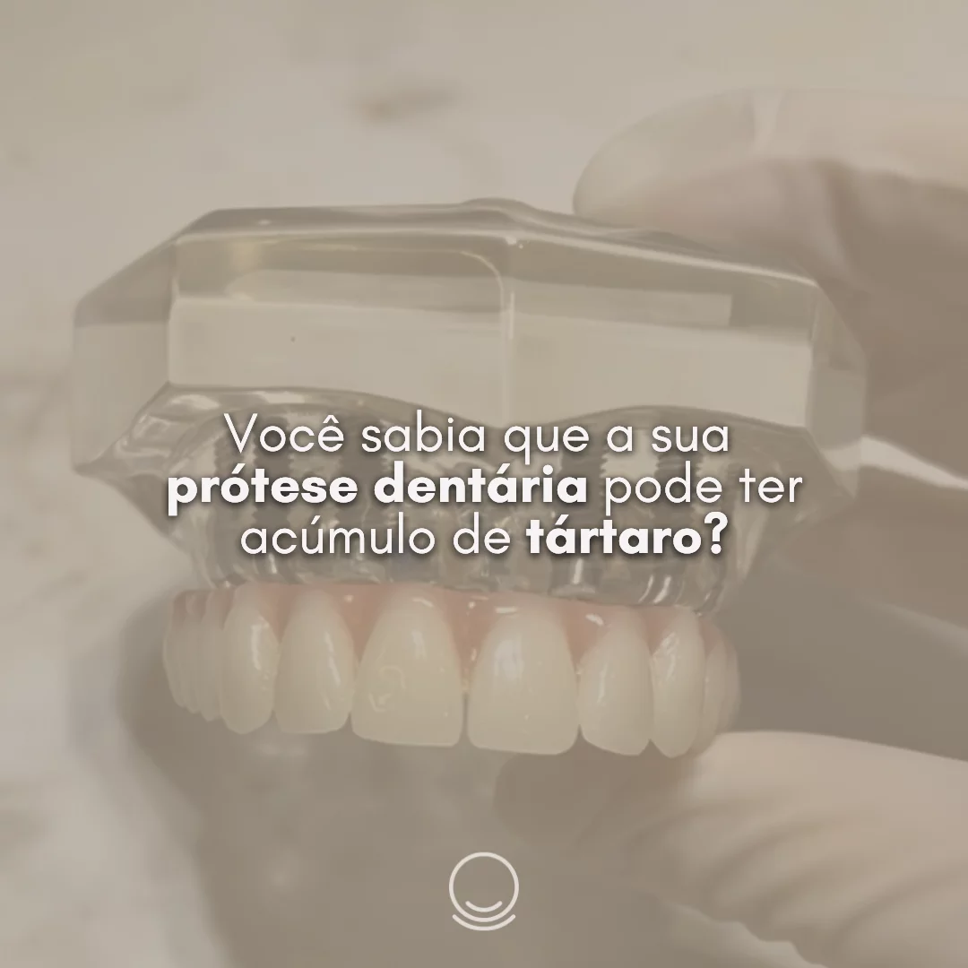 Você sabia que a sua prótese dentária pode ter acúmulo de tártaro?